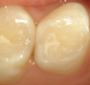 [Achieving Cavity-Free Smiles] From Your Infant’s First Dental Visit to Ongoing Care: Our E-E-A-T-Based Practical Guide | Tokyo International Dental Roppongi